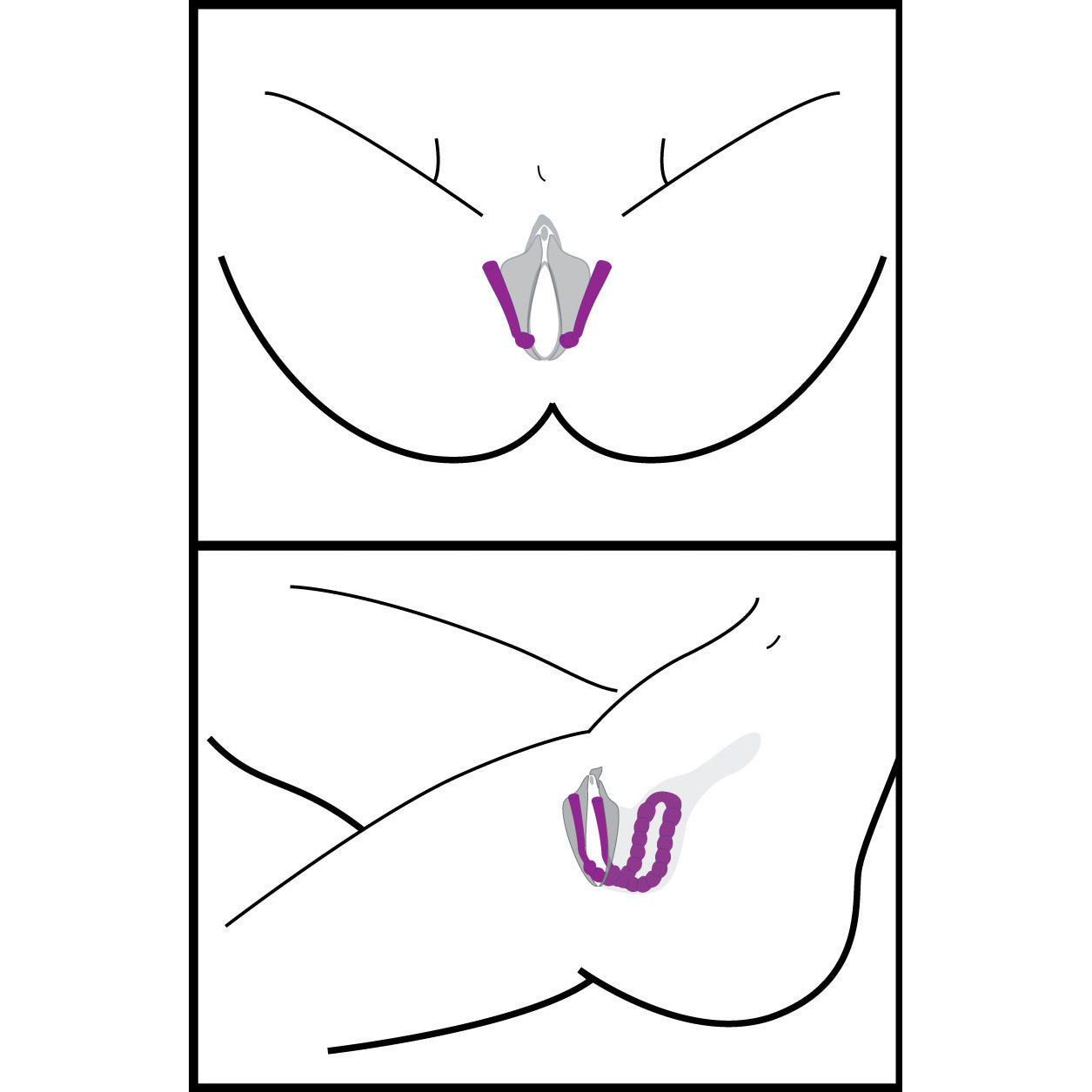 Frisky Oral Enhancing Hands Free Labia Spreader Purple